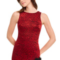 Tobi Dress